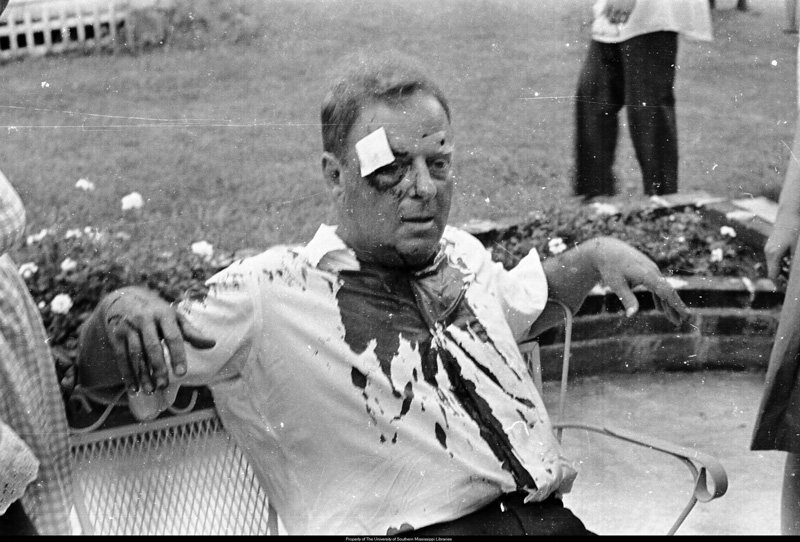 Arthur_Lelyveld_after_beating_July_10_1964